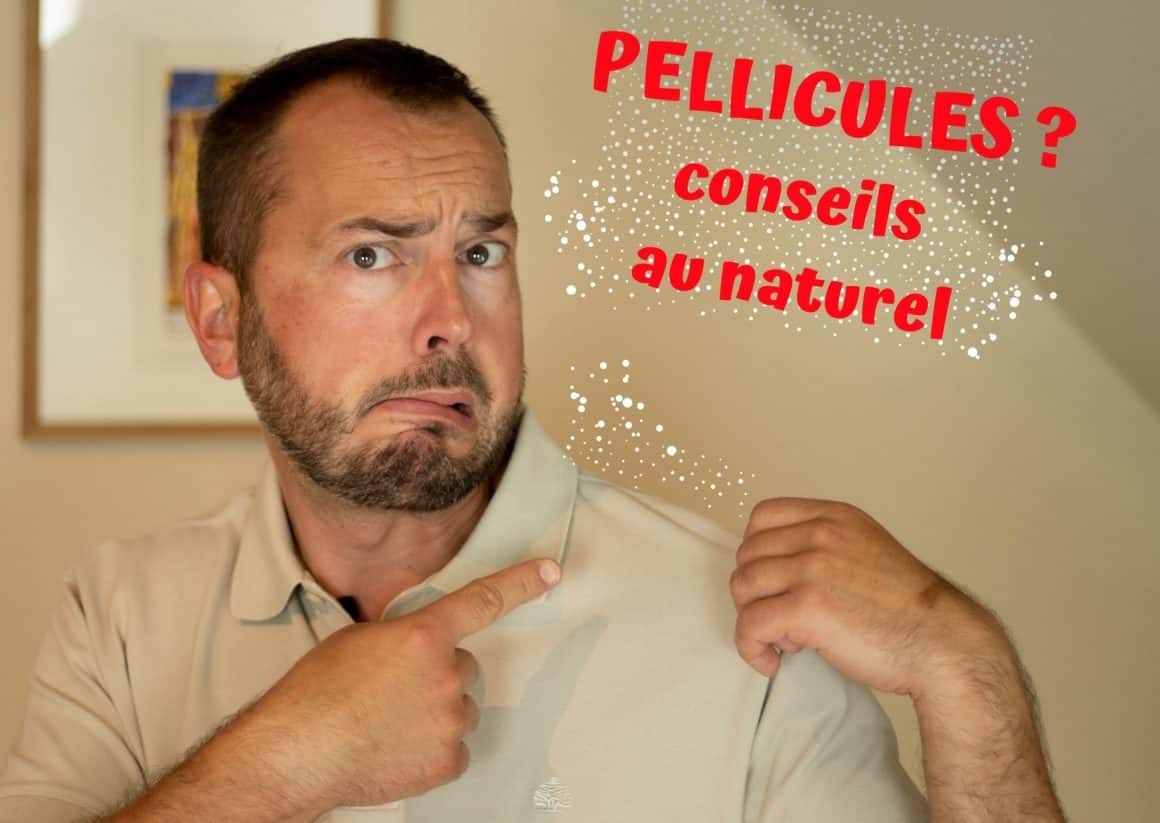 Conseils pour les pellicules